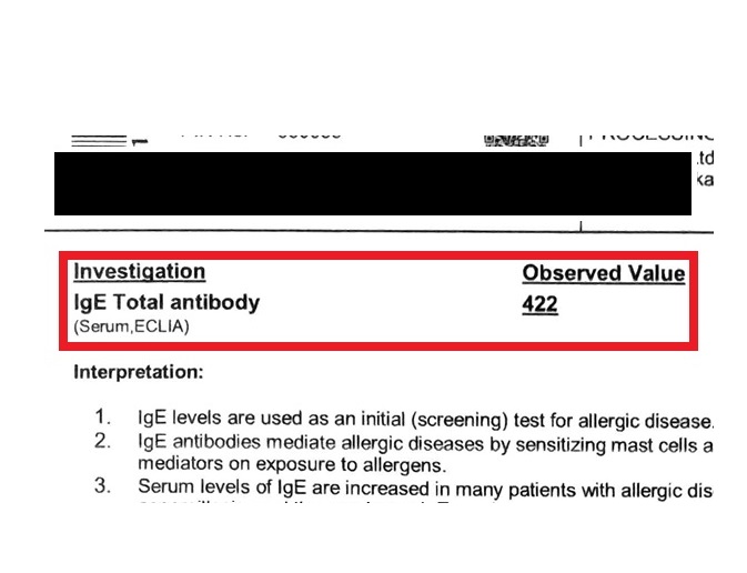 Allergy after treatment