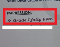 Fatty Liver after treatment